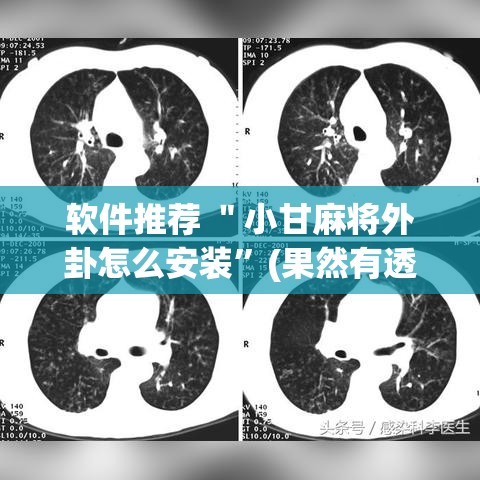 软件推荐 ＂小甘麻将外卦怎么安装”(果然有透视挂)