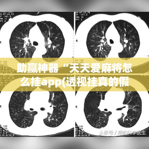 助赢神器“天天爱麻将怎么挂app(透视挂真的假的)
